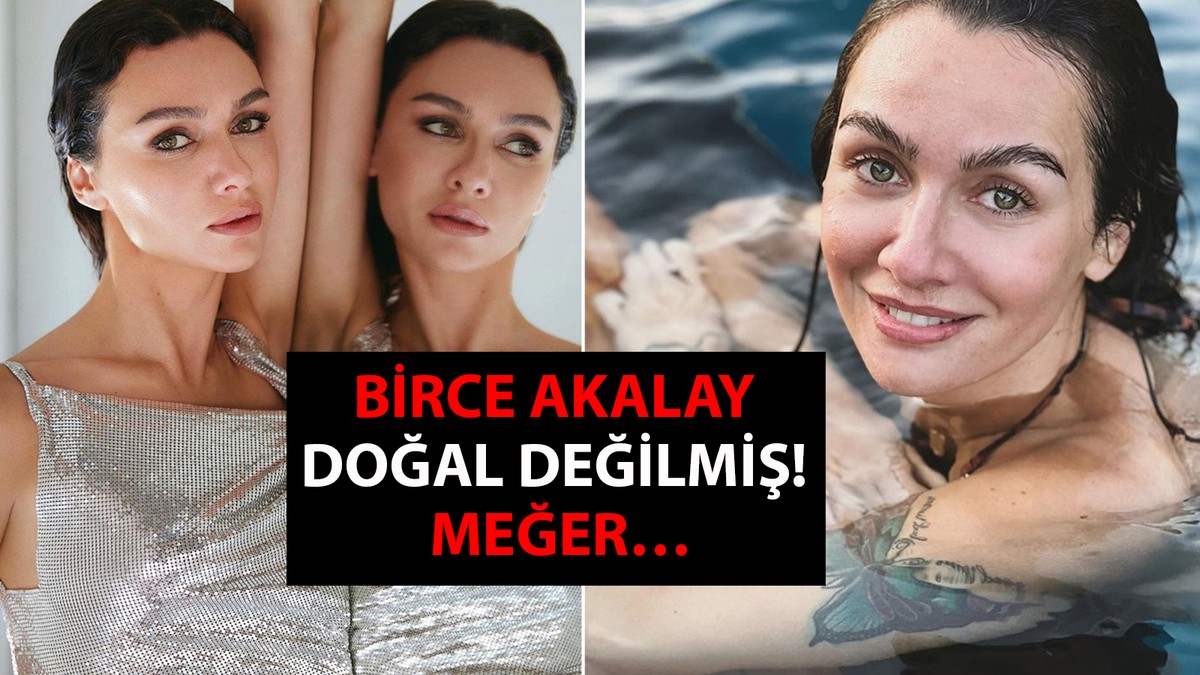 Birce Akalay doğal değilmiş! Meğer…