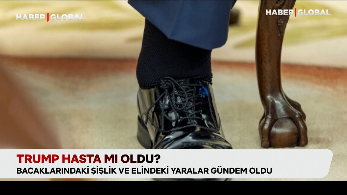 Trump hasta mı oldu?