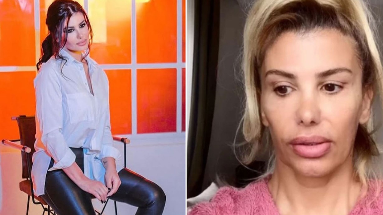 Botokstan zehirlenen Hatice'nin zor günleri... 'Olağan dışı bir şey yaşıyorum'