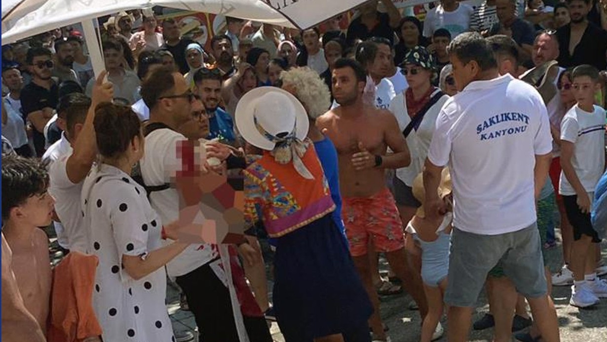 Ailesiyle kanyonda yürüyüş yaparken başına taş düşen çocuk ağır yaralandı