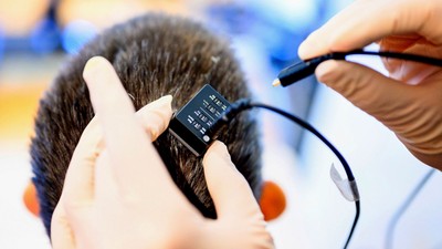 Bilim insanlarından çarpıcı çalışma: Düşünceyi konuşmaya çeviren cihaz geliştirildi