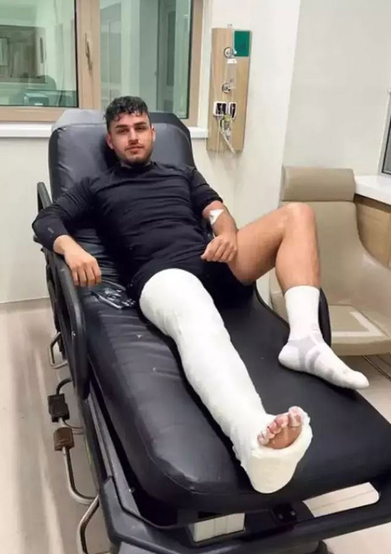 MasterChef Erim'den kötü haber! Tatilde kaza geçirdi - Resim : 2