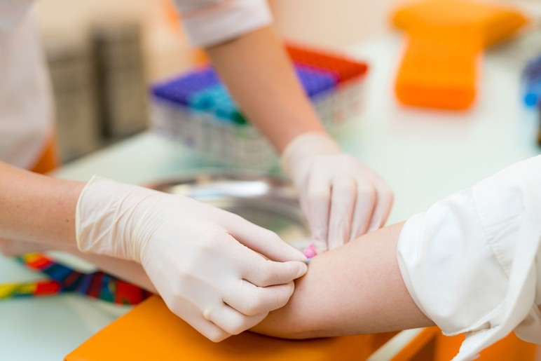 AIDS vakalarında korkutan artış, çocuklara da sıçradı - Resim : 2