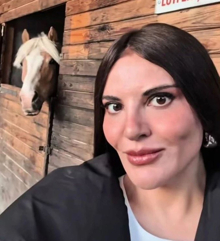 Göksel'den estetik iddialarına yanıt: O kişiyi tanımıyorum - Resim : 2