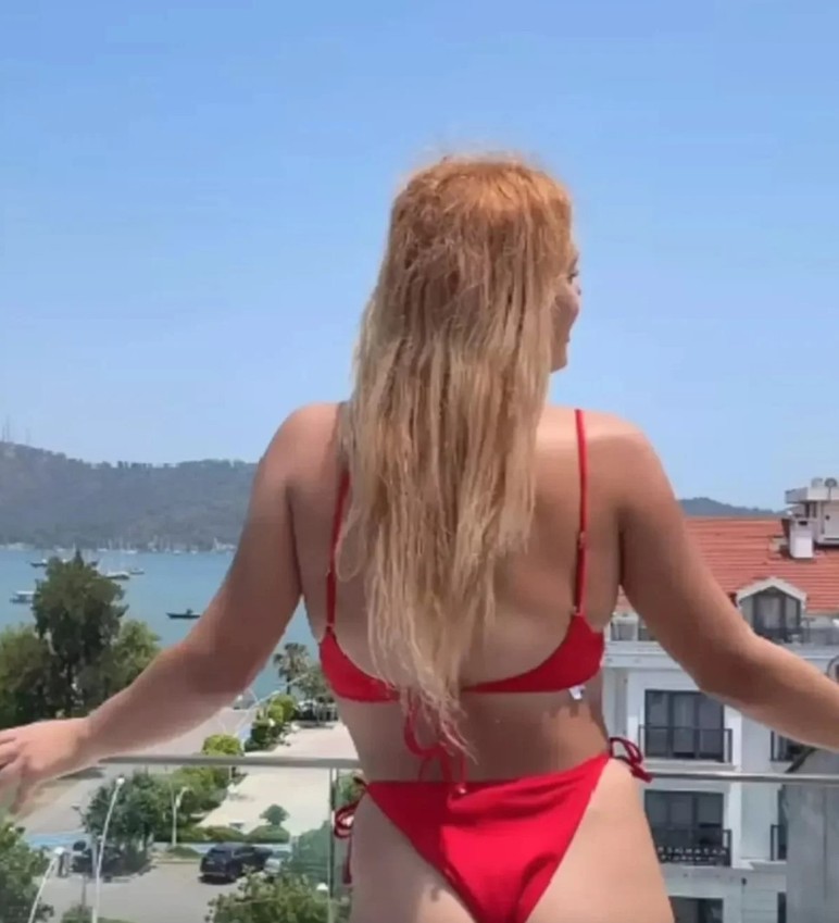 Survivor sonrası estetik yaptıran Almeda'nın bikinili pozu olay oldu - Resim : 2