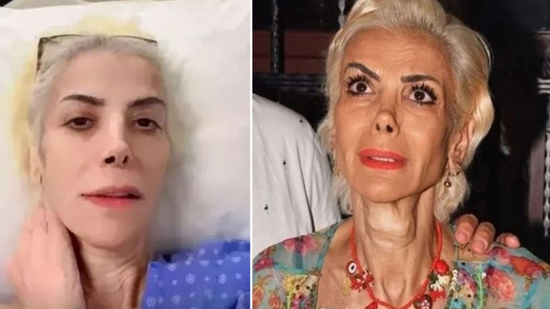 Kanserle mücadele eden Tanyeli'den kötü haber! "Bana dua edin"