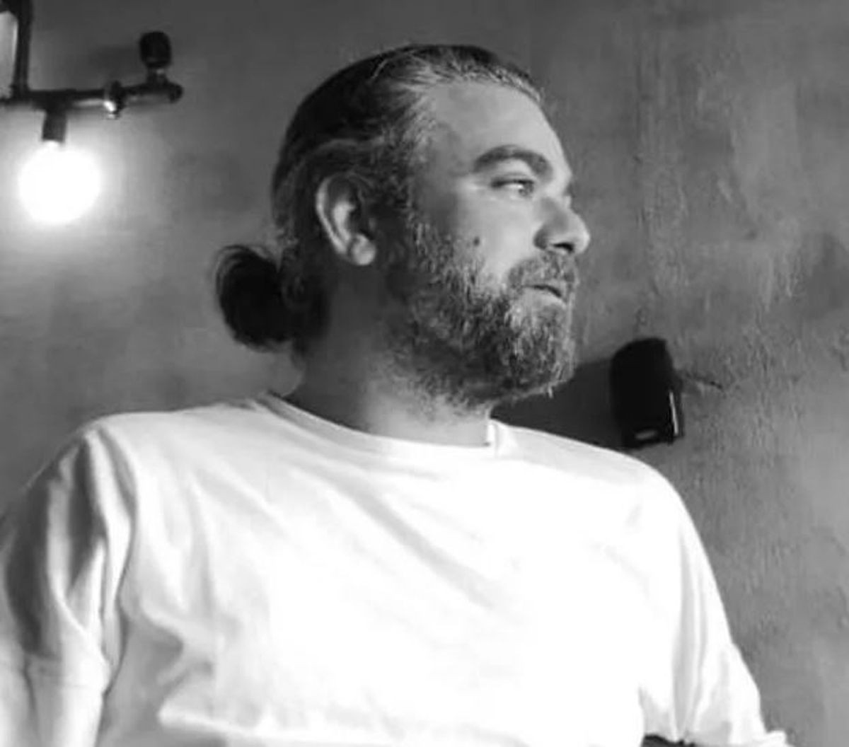 Çok Güzel Hareketler Bunlar'ın yıldızı Murat Eken son haliyle şoke etti! 