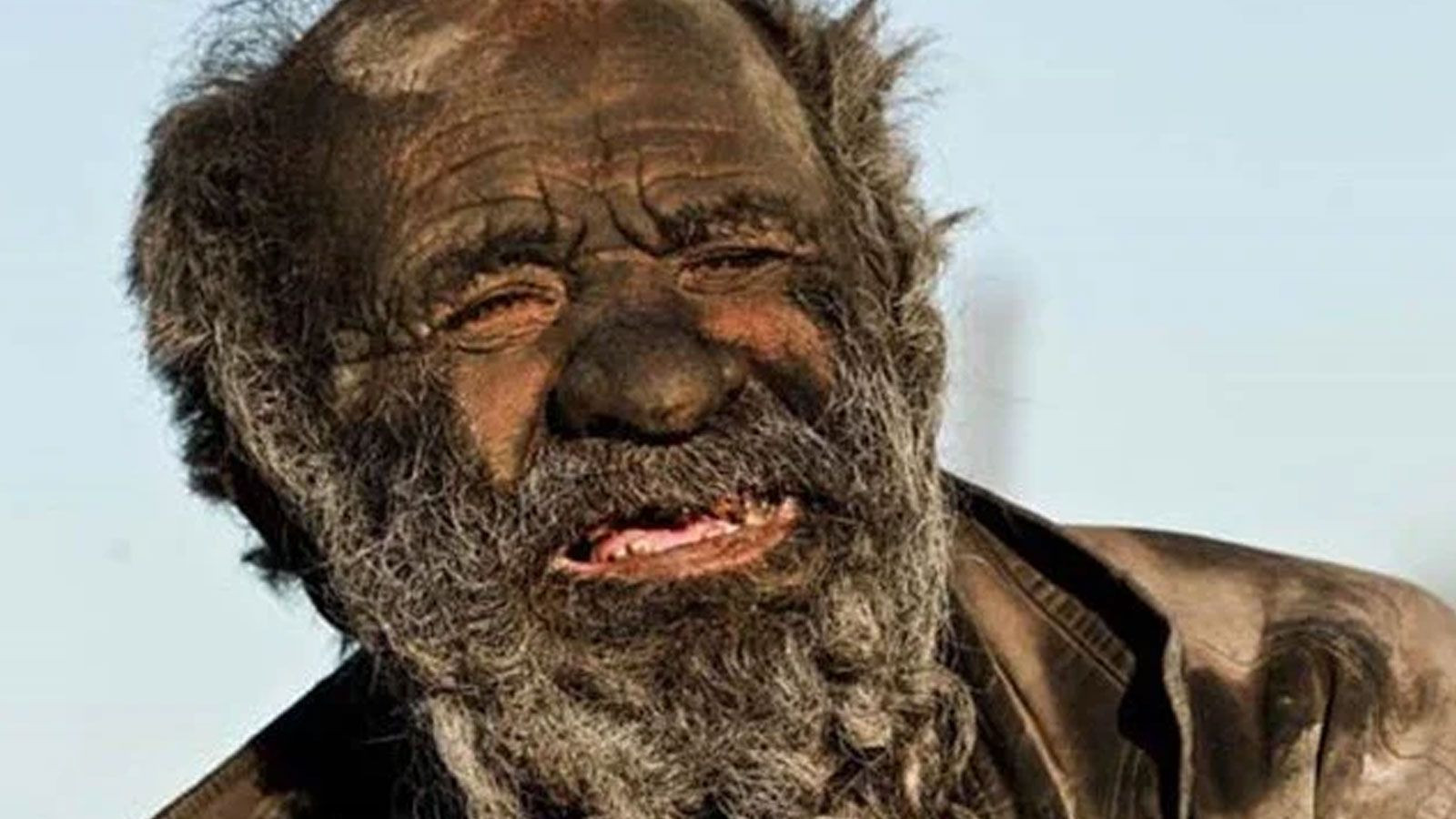 Dünya onu konuşmuştu! 70 yıldır yıkanmayan adam, yıkandıktan sonra öldü - Resim: 2