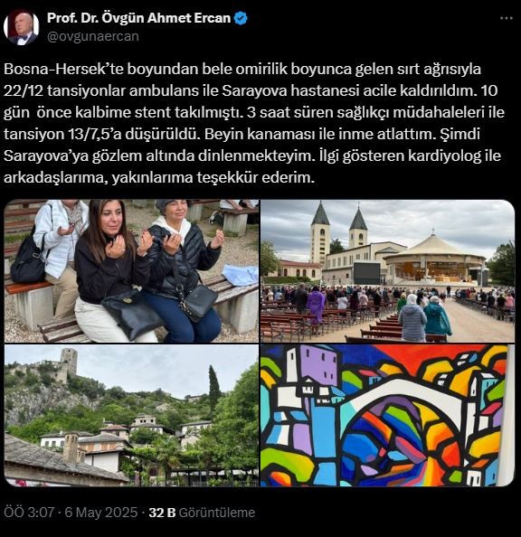 Prof. Dr. Ahmet Ercan beyin kanaması geçirdi - Resim : 1