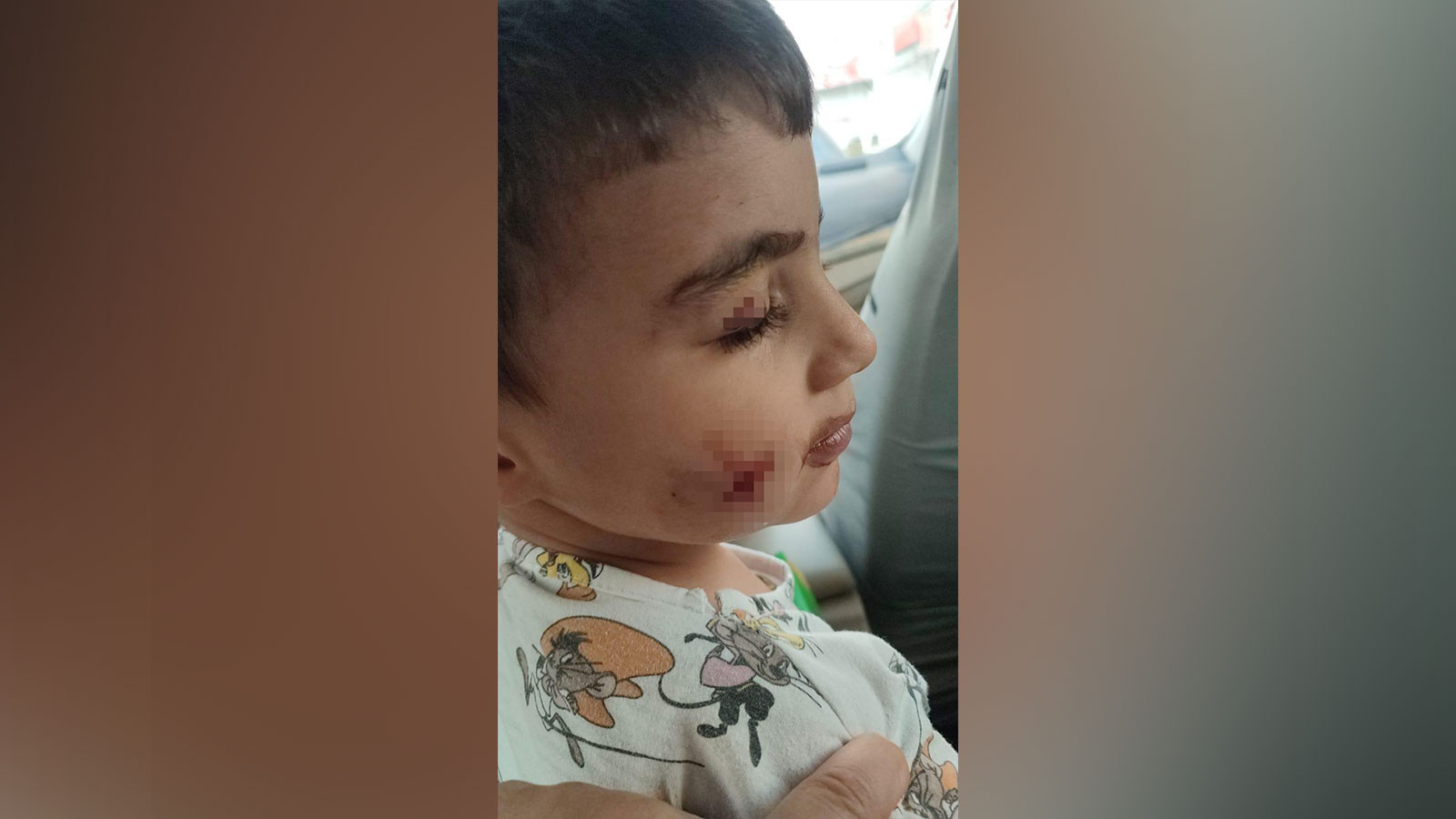 Ankara'da korkunç olay: Uyuyan çocuğu lağım faresi ısırdı